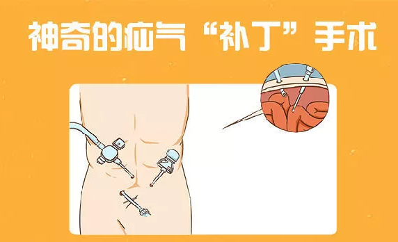 中国疝病专科联盟疝病治疗和研究分中心落户平原县第
